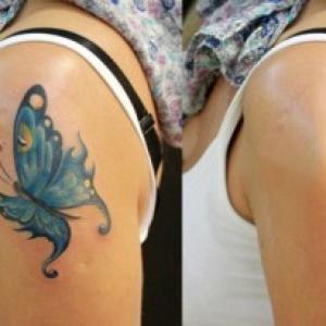 NEW! Неодимовый лазер в 